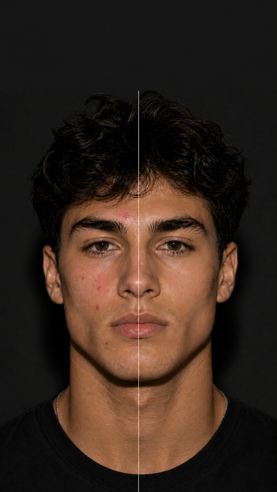 Before and after — visible redness reduction