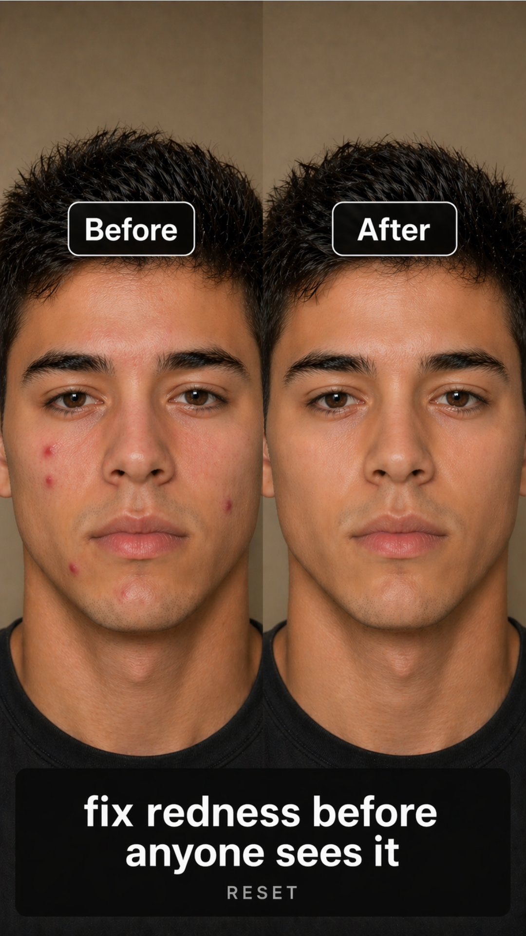 Before and after — visible redness reduction with RESET